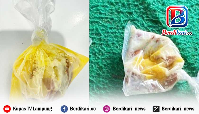 Program MBG Lambar Dievaluasi Usai Temuan Telur Setengah Matang di Sekolah